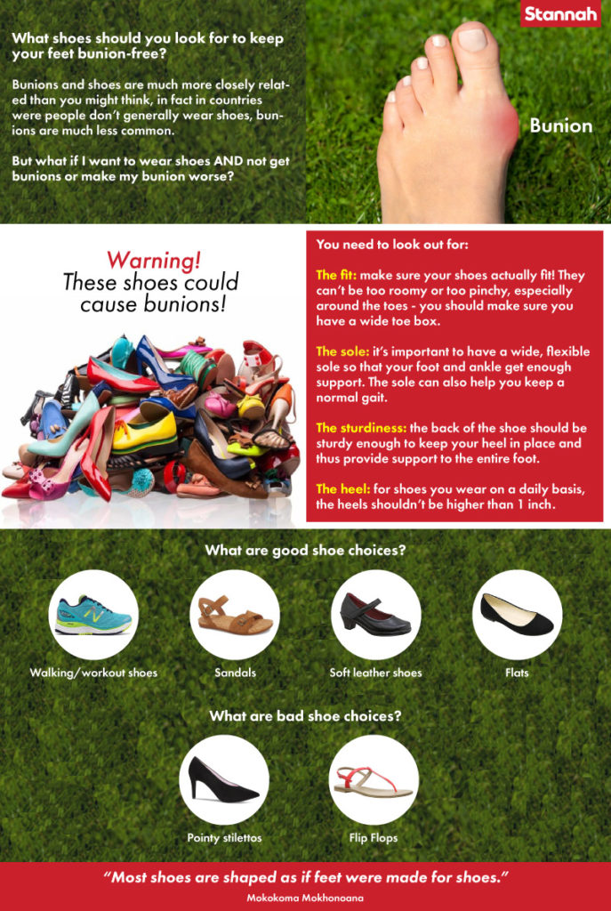 Bunions treatment and prevention Stannah